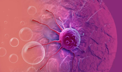 為什么在常規(guī)手術(shù)后仍需要做細(xì)胞免疫治療？