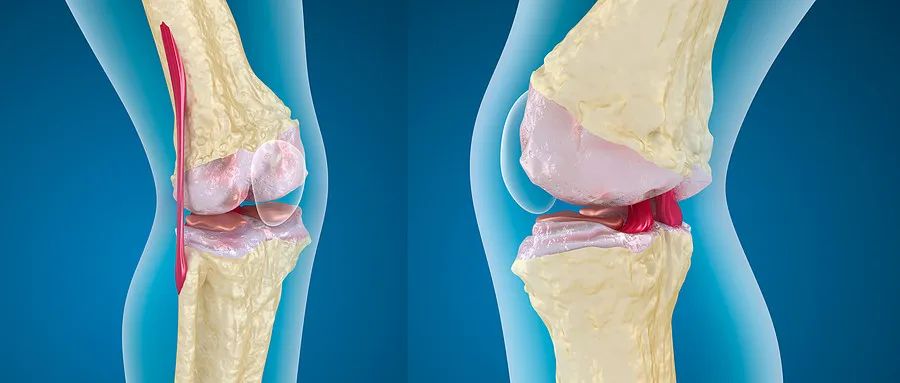 16項臨床＆875例患者，證實干細胞治療潛力巨大！